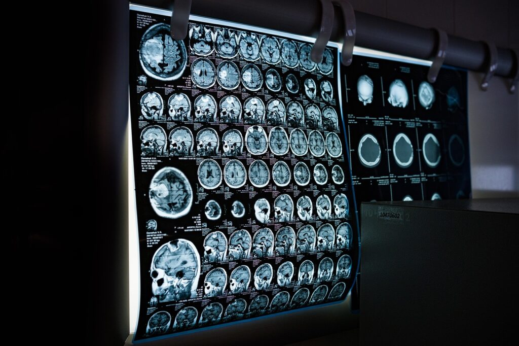 x-ray, mri, ct scan, computed tomography, magnetic resonance imaging, medicine, neurology, healthcare, x-ray, mri, mri, mri, mri, mri, ct scan, medicine, neurology, neurology, healthcare, healthcare